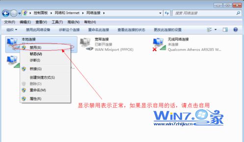 检查本地连接是否被禁用